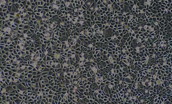 Primary Mouse Bronchial Epithelial Cells (BEpiC)