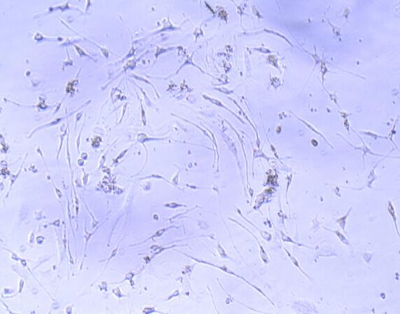 Primary Mouse Adipose-derived Mesenchymal Stem Cells (ADSCs)