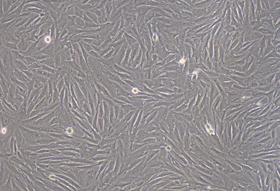 Primary Rabbit Adipose-derived Mesenchymal Stem Cells (ADSCs)