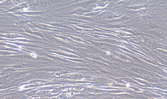 Primary Human Subcutaneous Preadipocytes (SPrAD)