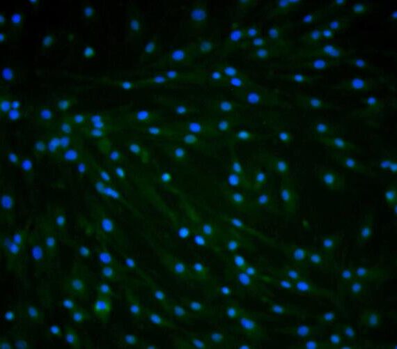 Primary Rat Subcutaneous Preadipocytes (SPrAD)