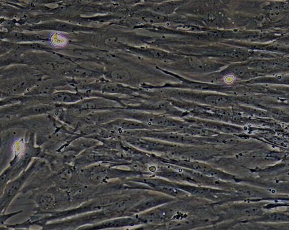 Primary Rat Pulmonary Fibroblasts (PF)