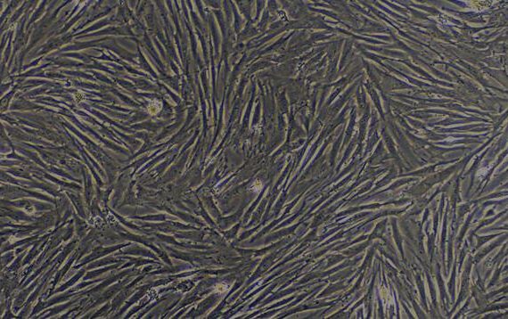 Primary Rabbit Pulmonary Fibroblasts (PF)