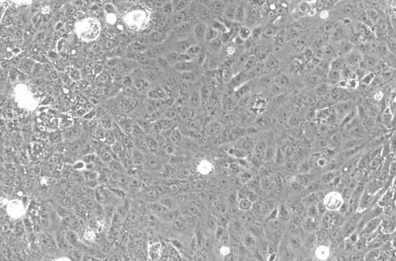 Primary Rabbit Cervical Epithelial Cells (CrEC)