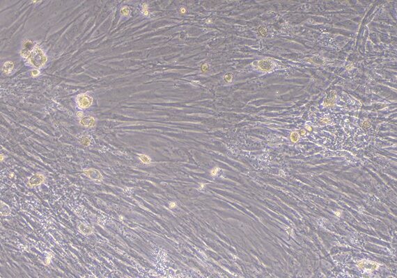 Primary Mouse Thymic Fibroblasts (TF)