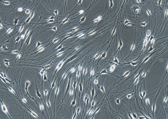 Primary Rat Schwann Cells (ratSC)