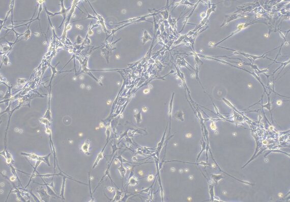Primary Rabbit Schwann Cells (rabbitSC)