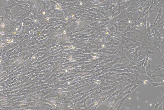 Primary Rat Thyroid Fibroblasts (TF)