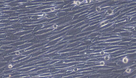 Primary Rabbit Thyroid Fibroblasts (TF)