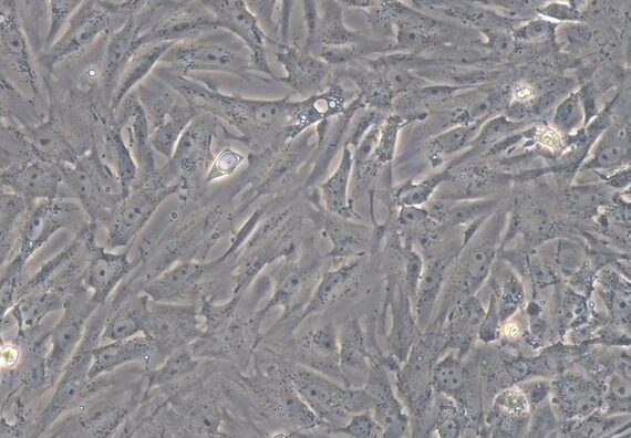 Primary Mouse Uterine Smooth Muscle Cells (USMC)