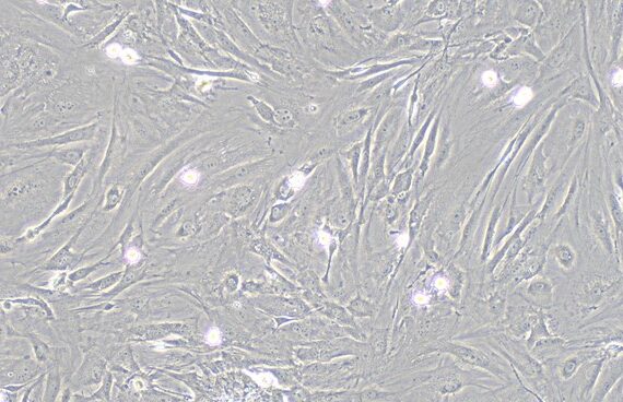 Primary Mouse Meningeal Cells (MC)