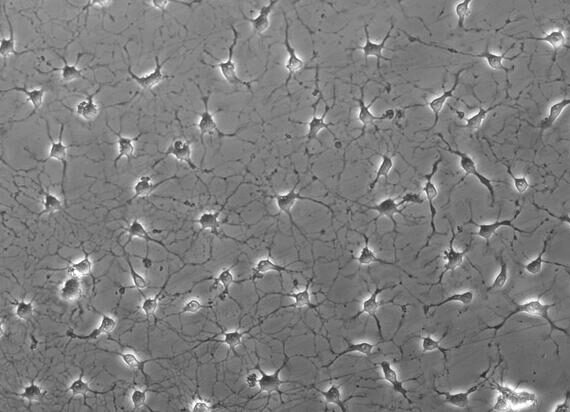 Primary Mouse Microglia Cells (MC)