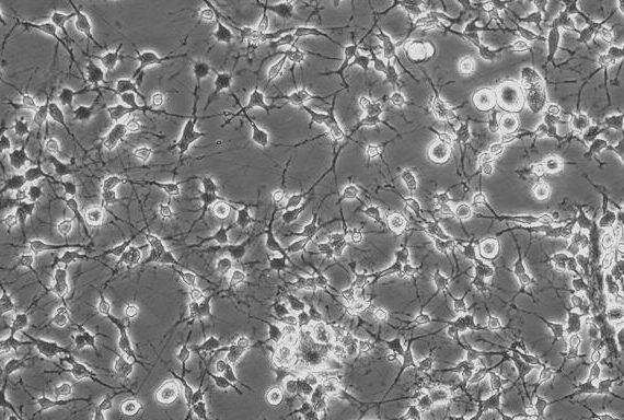 Primary Rat Microglia Cells (MC)