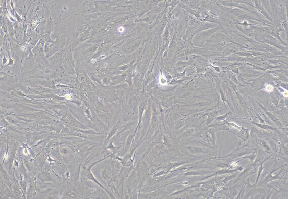 Primary Mouse Corneal Fibroblasts (CF)