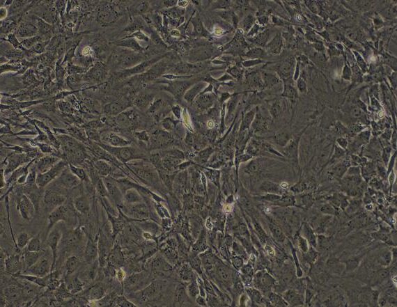 Primary Mouse Skeletal Muscle Cells (SkMC)