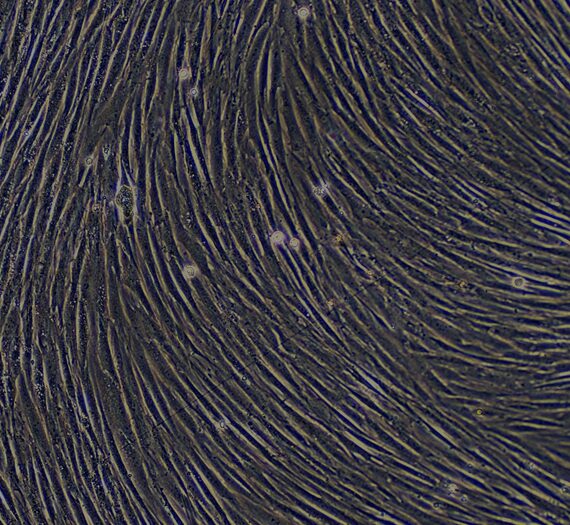 Primary Rabbit Skeletal Muscle Cells (SkMC)