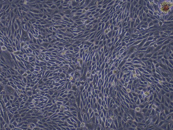 Primary Mouse Renal Tubular Epithelial Cells (RTEC)