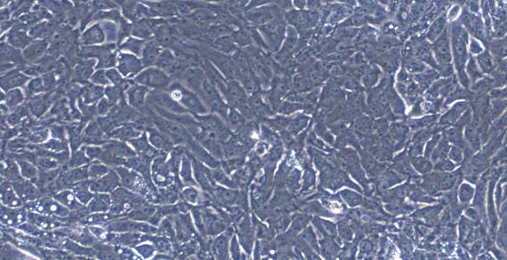 Primary Porcine Renal Tubular Epithelial Cells (RTEC)