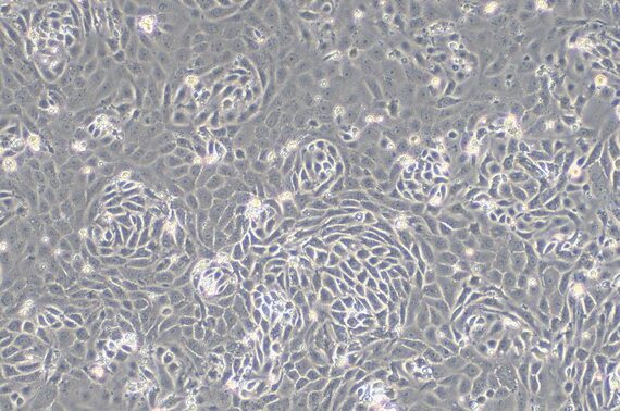 Primary Rat Renal Tubular Epithelial Cells (RTEC)