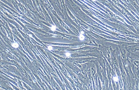Primary Canine Bladder Smooth Muscle Cells (BSMC)