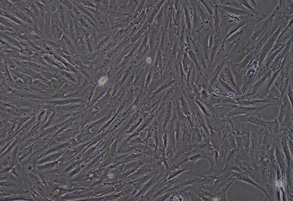 Primary Rat Bladder Smooth Muscle Cells (BSMC)