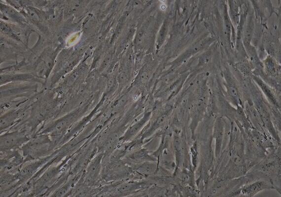 Primary Rabbit Bladder Smooth Muscle Cells (BSMC)