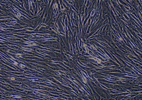 Primary Canine Bladder Stromal Fibroblasts (BSF)
