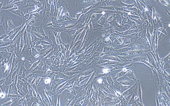 Primary Caprine Bladder Stromal Fibroblasts (BSF)