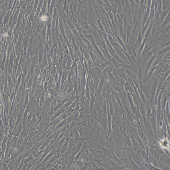 Primary Mouse Bladder Stromal Fibroblasts (BSF)