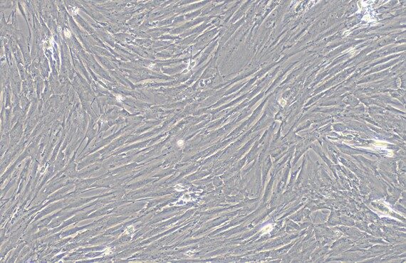 Primary Rat Bladder Stromal Fibroblasts (BSF)