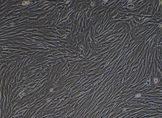 Primary Rabbit Bladder Stromal Fibroblasts (BSF)