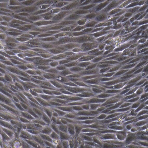 Primary Mouse Renal Cortical Epithelial Cells (RCEC)