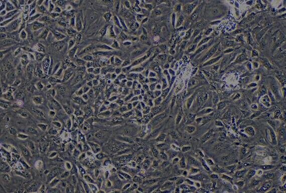 Primary Rat Renal Cortical Epithelial Cells (RCEC)