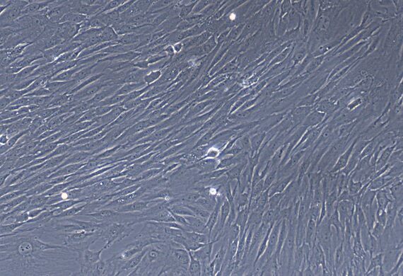 Primary Mouse Tracheal Smooth Muscle Cells (TSMC)