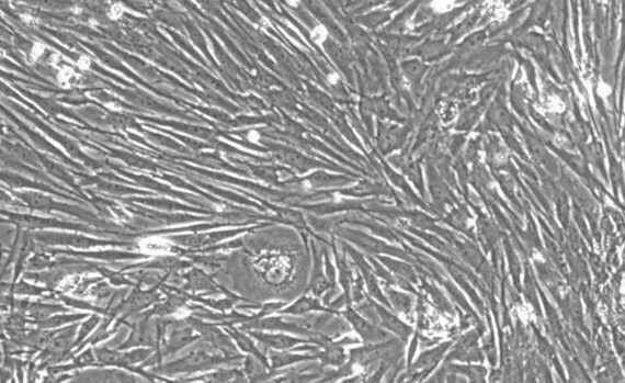 Primary Porcine Tracheal Smooth Muscle Cells (TSMC)