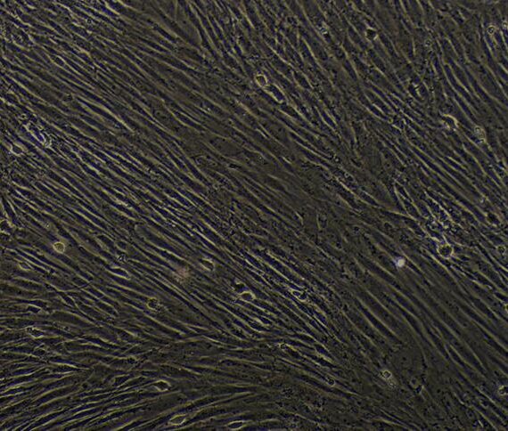 Primary Rabbit Tracheal Smooth Muscle Cells (TSMC)