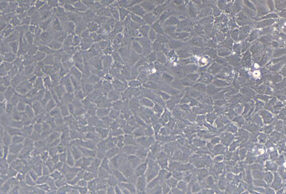 Primary Rat Tracheal Epithelial Cells (TEC)
