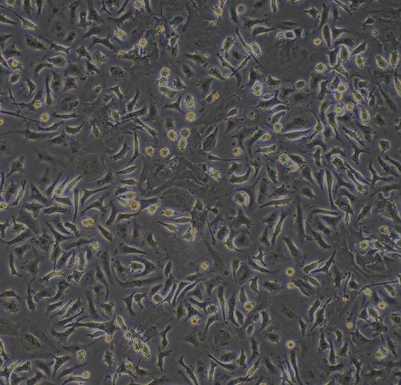 Primary Mouse Hepatic Stellate Cells (HSC)