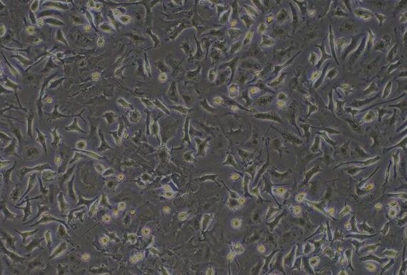 Primary Rat Hepatic Stellate Cells (HSC)