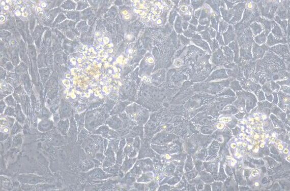 Primary Human Adult Epidermal Keratinocytes (AEK)