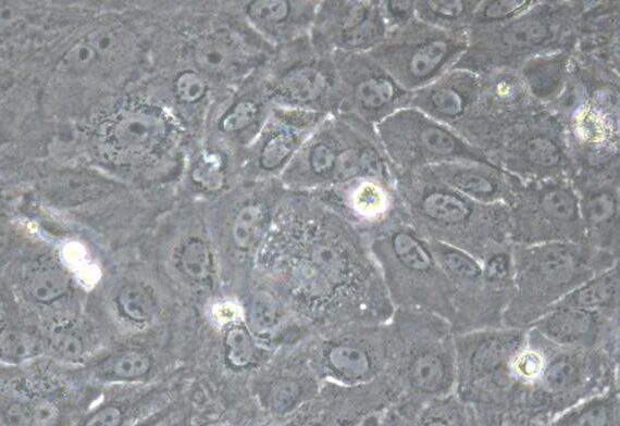 Primary Canine Neonatal Epidermal Keratinocytes (NEK)