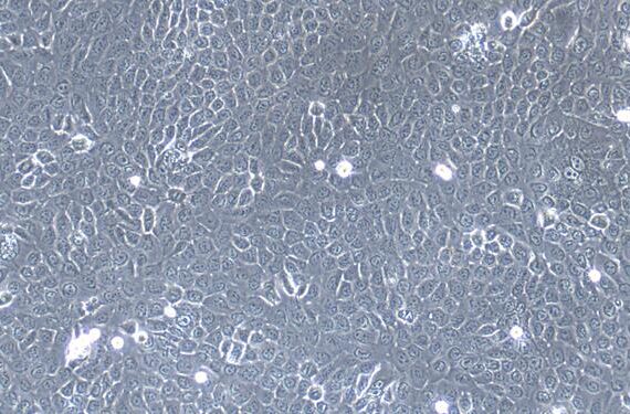 Primary Mouse Neonatal Epidermal Keratinocytes (NEK)