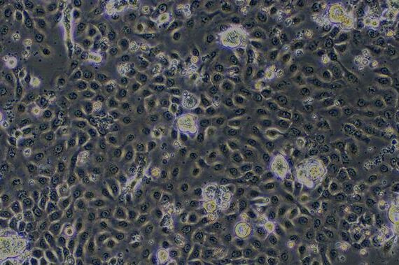 Primary Rat Neonatal Epidermal Keratinocytes (NEK)