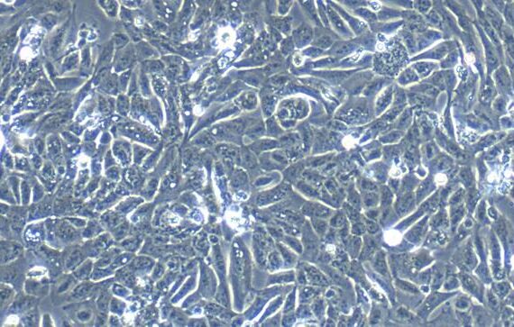 Primary Rabbit Neonatal Epidermal Keratinocytes (NEK)