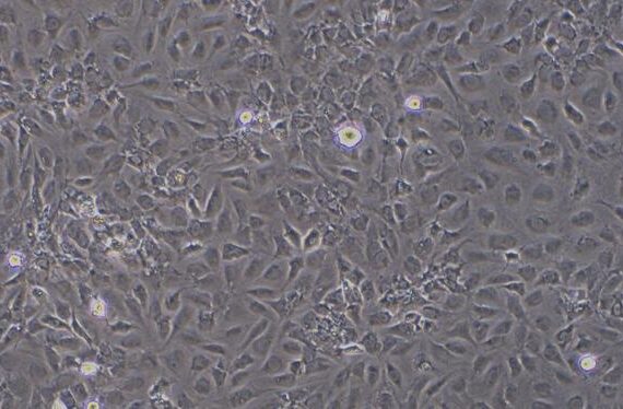 Primary Mouse Dermal Microvascular Endothelial Cells (DMEC)