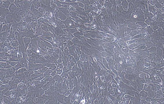 Primary Caprine Visceral Preadipocytes (VPA)