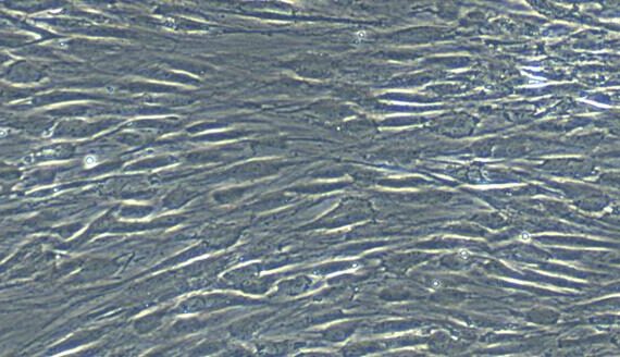 Primary Human Visceral Preadipocytes (VPA)