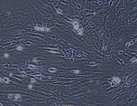 Primary Mouse Visceral Preadipocytes (VPA)