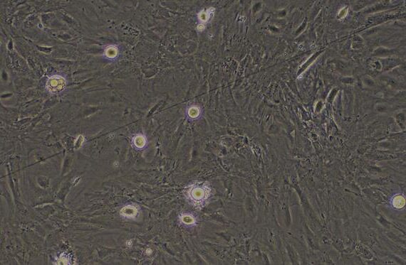 Primary Rat Visceral Preadipocytes (VPA)