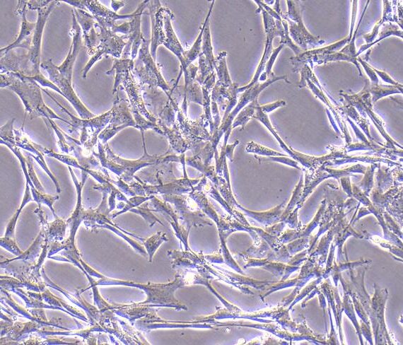 Primary Mouse Bone Marrow-derived Mesenchymal Stem Cells (BMMSCs)